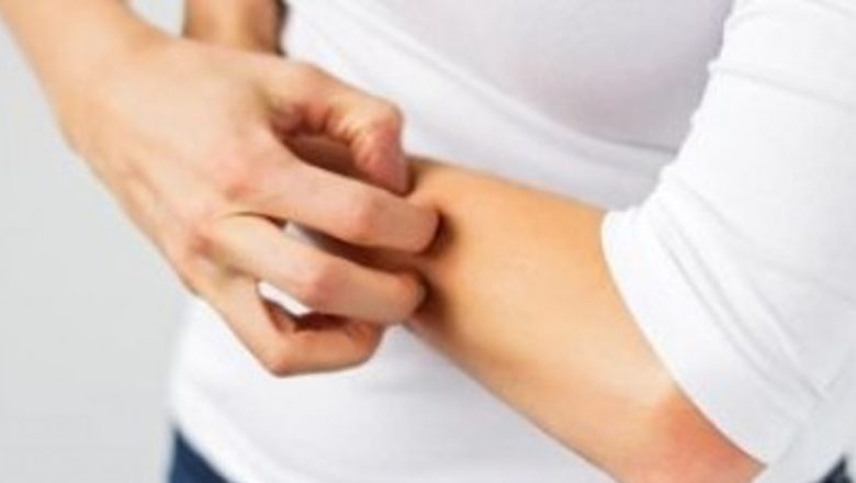 Remedii Naturiste pentru Zona Zoster: O Analiză Detaliată a Soluțiilor Eficiente