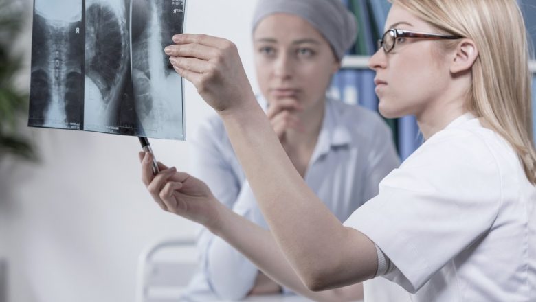 Cancerul pulmonar: O problemă de sănătate publică în România și în lume