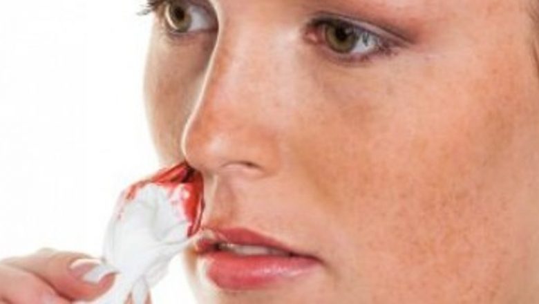 Cum să gestionăm sângerările nazale: Mituri, tratamente și măsuri preventive