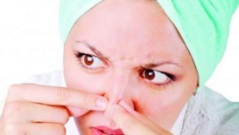 Acneea la Adulți: Cauze, Tratamente și Implicații Asupra Sănătății
