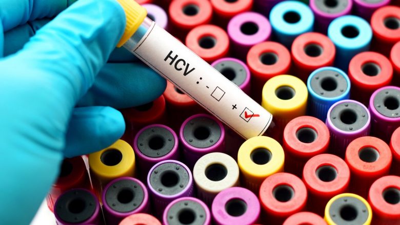 Hepatita C: O Luptă pentru Vindecare și Viitorul Tratamentului
