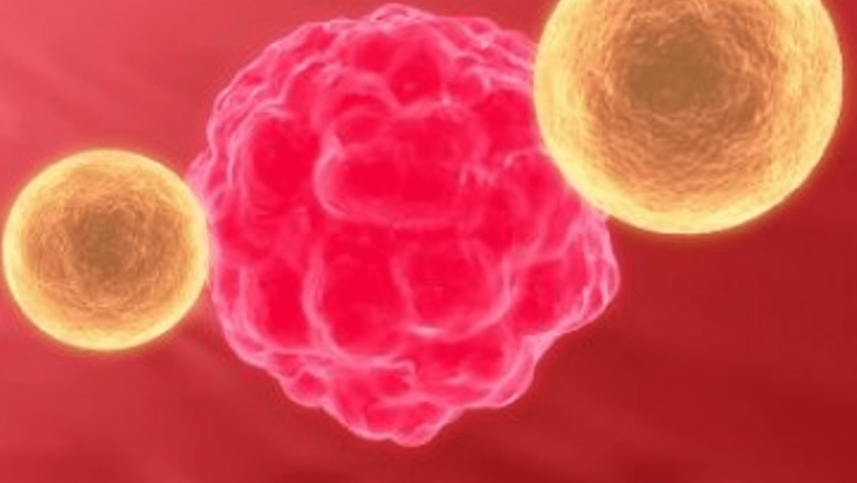 Ziua Mondială de Luptă Împotriva Cancerului: O Urgență În Sănătatea Publică