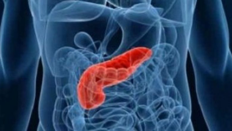 Cancerul de pancreas: O amenințare tăcută și devastatoare