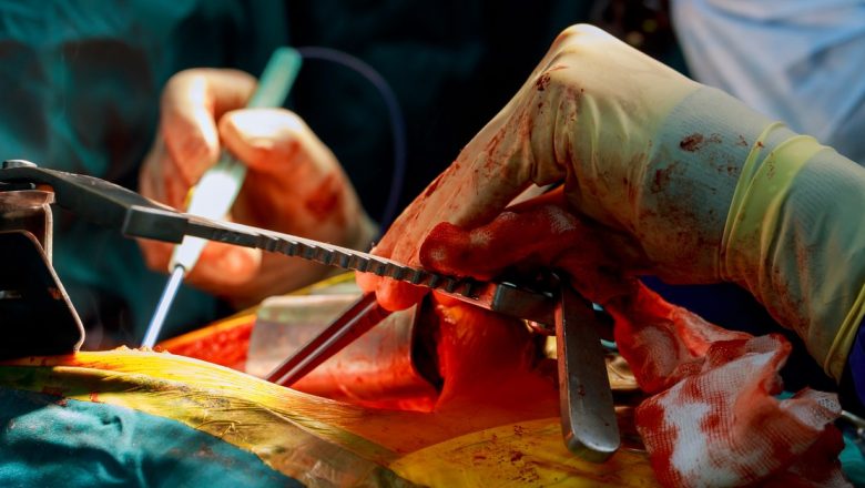 Transplantul hepatic: Indicații, complicații și perspective pe termen lung
