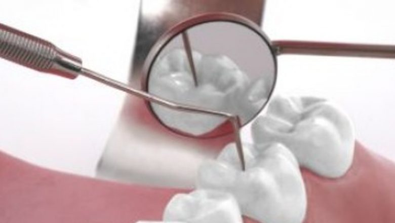 Gingiile Inflamate: O Problemă Subestimată a Sănătății Orale și Soluții Naturale pentru Tratarea Lor