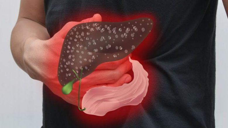 Ghid Complet pentru Detoxifierea Ficatului: Metode Eficiente și Implicațiile Sănătății
