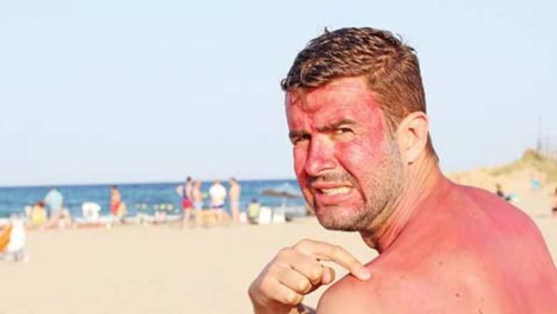 Arsurile Solare și Riscurile Asociate: De Ce Protecția Pielii Este Crucială