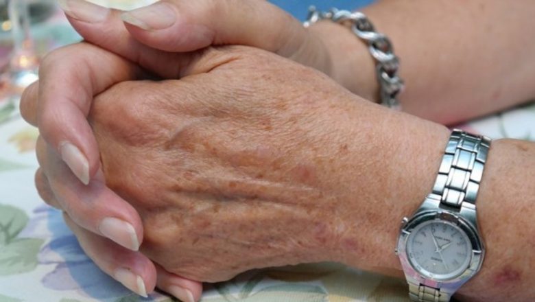 Ghid Complet pentru Îndepărtarea Petelor de pe Mâini: Remedii Naturale și Sfaturi Practice