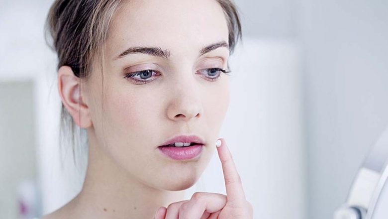 Remedii Naturale pentru Herpes: Cum să Scapi de Rănile Inestetice și Să Îmbunătățești Sănătatea Pielii