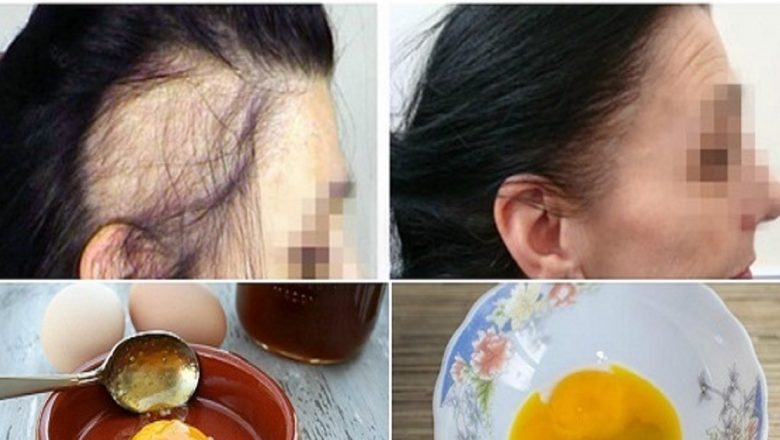 Regenerarea și Creșterea Părului: Tratamentul Natural cu Ingrediente din Bucătărie