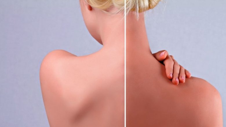 Ghid complet pentru aplicarea autobronzantului: reguli esențiale pentru un bronz perfect