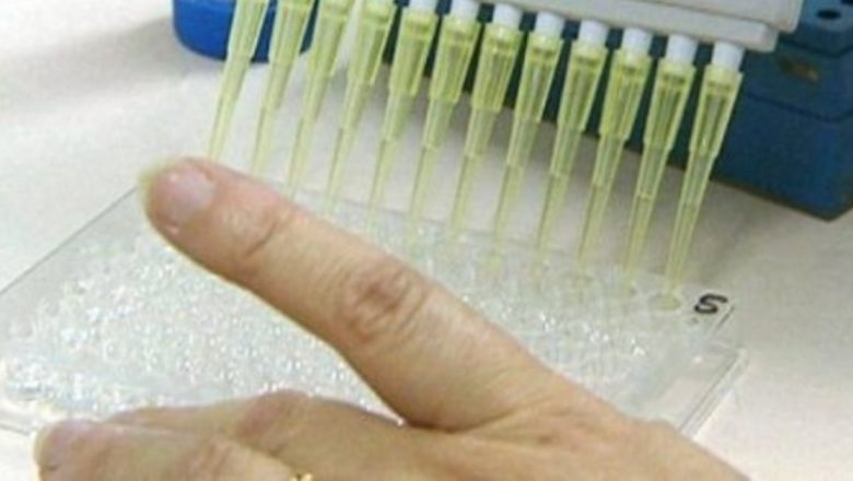 Hepatita A: Tot ce trebuie să știi despre transmitere, simptome și tratament