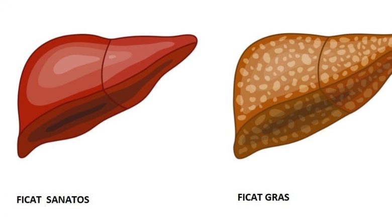 Dieta Ideală pentru Combaterea Ficatului Gras: Strategii și Recomandări Esențiale