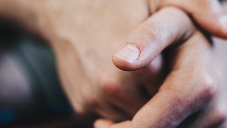Panarițiu: Simptome, Factori Favorizanți și Modalități de Prevenție și Tratament