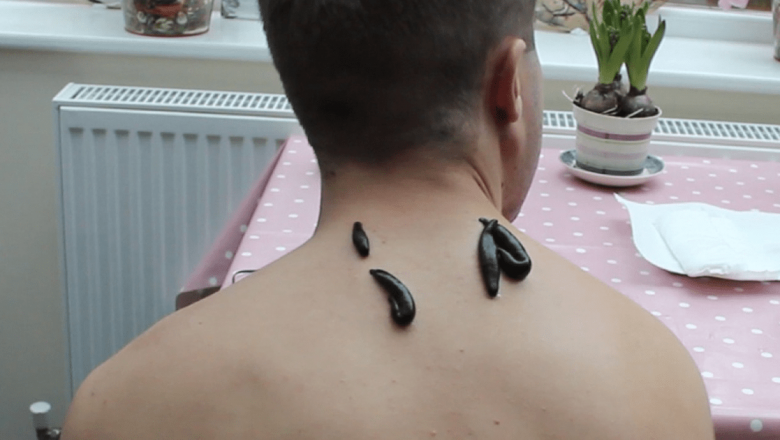 Terapia cu lipitori: O abordare alternativă pentru îmbunătățirea circulației sanguine și nu numai