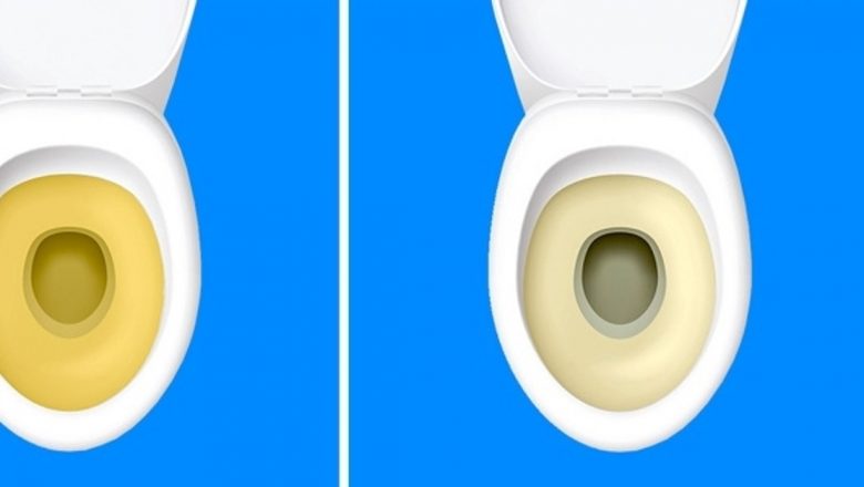 Modificările urinării: Semne de alarmă pe care nu trebuie să le ignori