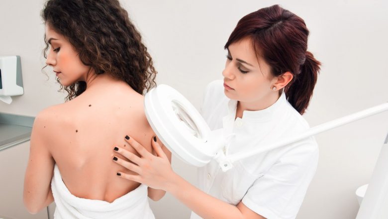 Cancerul de Piele: Tipuri, Factori de Risc și Implicații pentru Sănătate