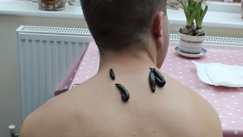 Terapia cu Lipitori: O Străveche Practică Medicinală cu Beneficii Moderne