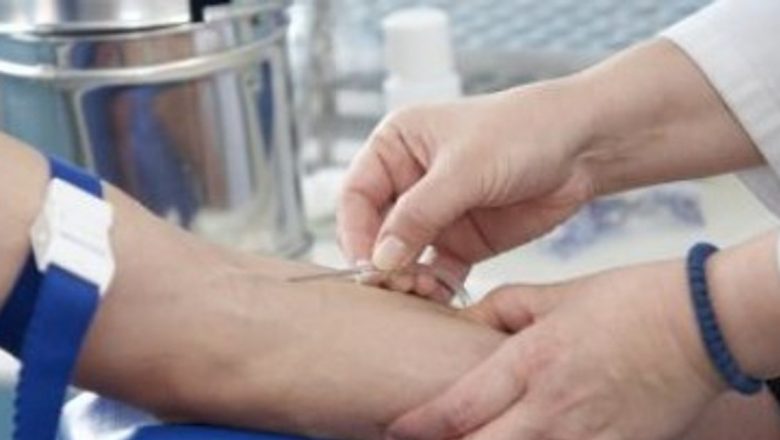 Factorul reumatoid: O fereastră crucială în diagnosticul artritei reumatoide