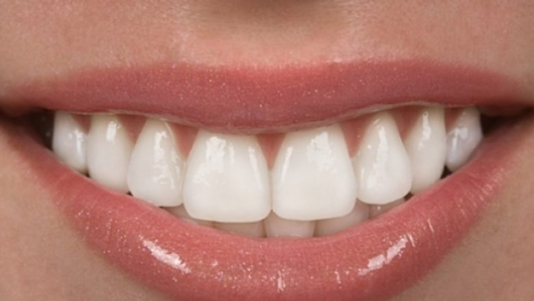 Parodontoza: Înțelegerea, Factorii de Risc și Tratamentul acestei Afecțiuni Dentare Critice