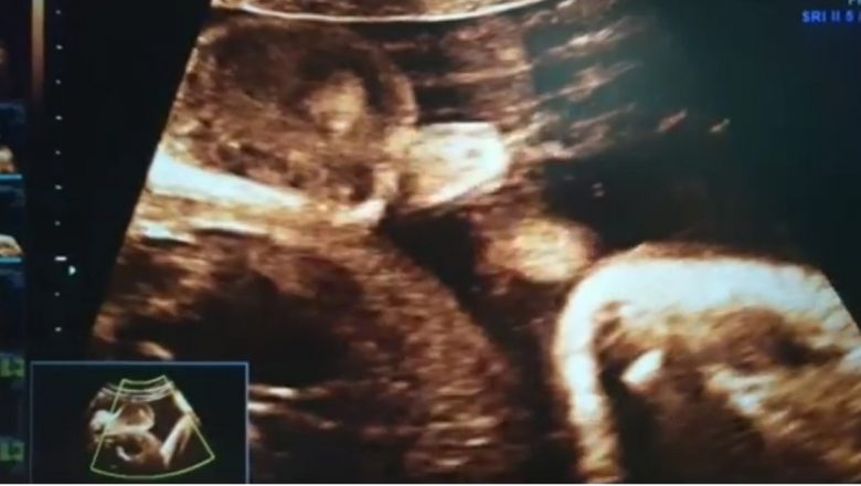 Revelații Incredibile din Viața Intrauterină: Activitățile Surprinzătoare ale Bebelușilor