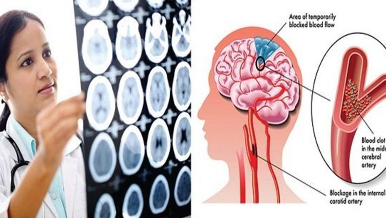 Semnele Durerii de Cap: Când Trebuie să Fii Îngrijorat și să Ceri Ajutor Medical