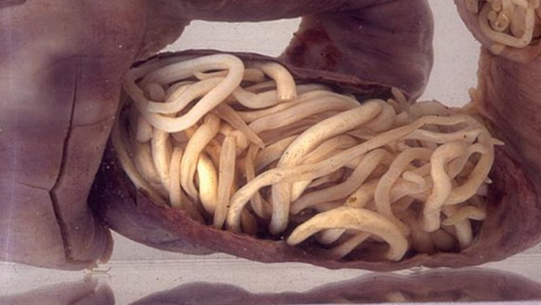 Paraziții Intestinali: Simptome, Tratament și Implicații pentru Sănătatea Ta