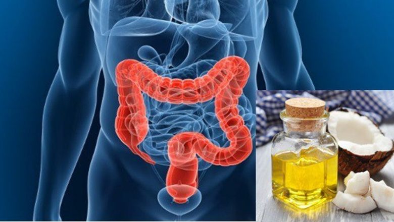 Uleiul de cocos: O speranță în lupta împotriva cancerului de colon