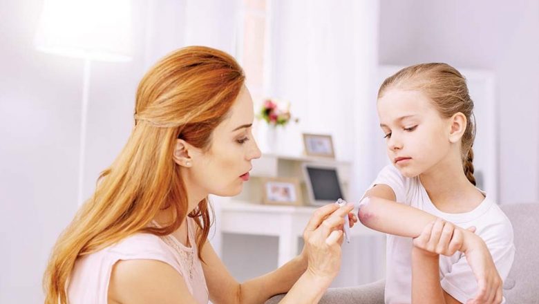 Arnica: Beneficiile și Utilizările Acestui Remediu Natural pentru Piele și Musculatură