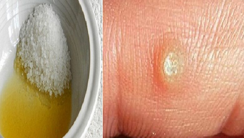 Remedii Naturale Eficiente pentru Eliminarea Negilor: O Perspectivă Detaliată