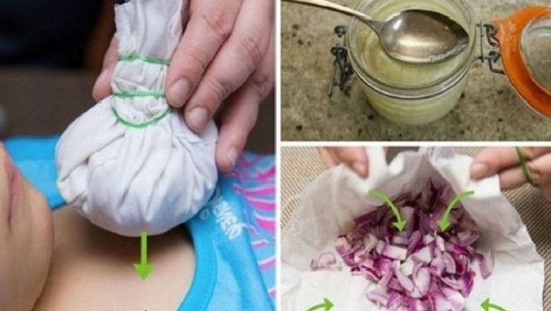 Ceapa: Remediul Naturist cu Proprietăți Miraculoase Împotriva Gripei și Nu Numai