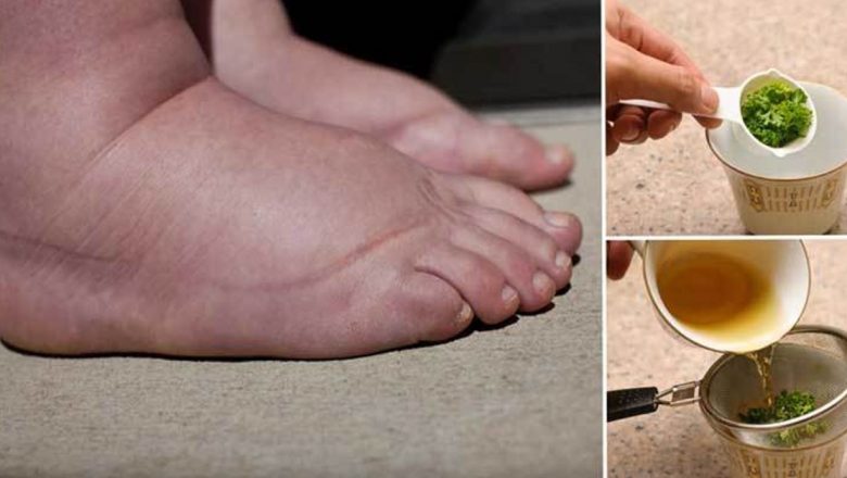 Remedii Naturiste Eficiente pentru Reducerea Retenției de Apă: O Analiză Detaliată