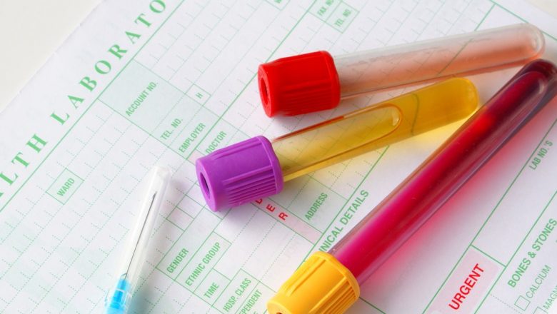 Ghidul complet al analizelor medicale anuale: Ce trebuie să știi pentru o sănătate optimă