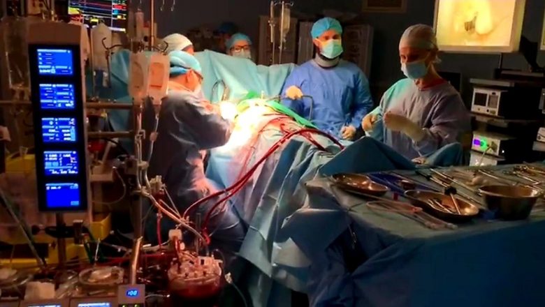 Inovații în Chirurgia Cardiacă: Beneficiile Procedurii Endoscopice de Tratare a Valvei Mitrale