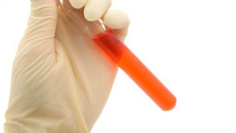 Impactul Hepatitei C: O Boală Multidimensională Care Afectează Întreaga Sănătate
