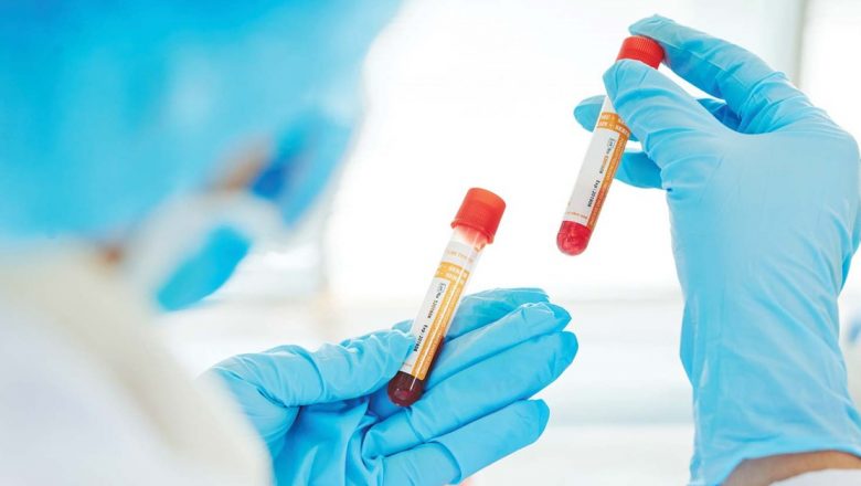 Menopauza Precoce: O Provocare Ușor de Ignorat, Dar cu Implicații Profunde