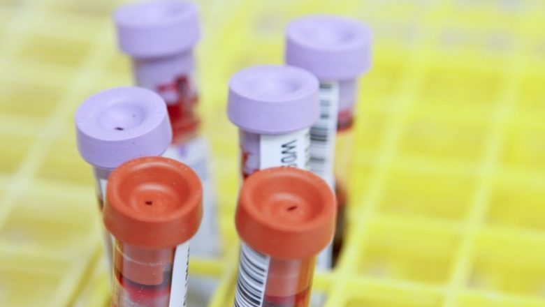 Creșterea testărilor COVID-19 în România: O măsură esențială pentru combaterea pandemiei