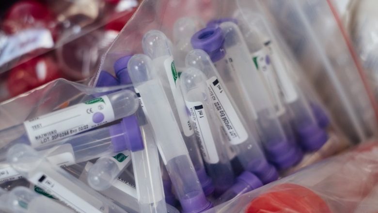 Strategia de Testare COVID-19 în România: O Analiză Detaliată a Măsurilor Întreprinse de Nelu Tătaru