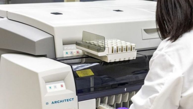 Testele de anticorpi COVID-19: O nouă eră în înțelegerea pandemiei și a imunității