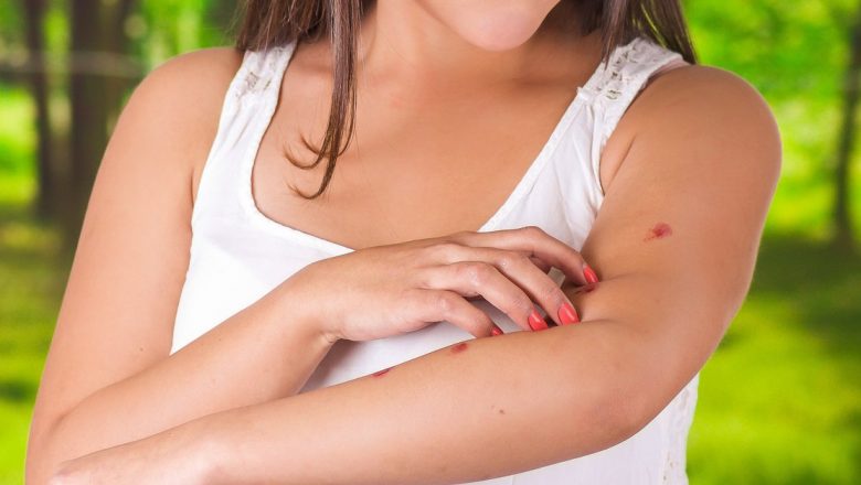 Remedii Naturale Eficiente pentru Combaterea Insectelor: O Analiză Detaliată