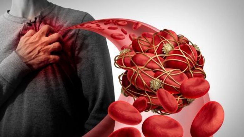 Cheagurile de sânge: Prevenire, recunoaștere și tratament