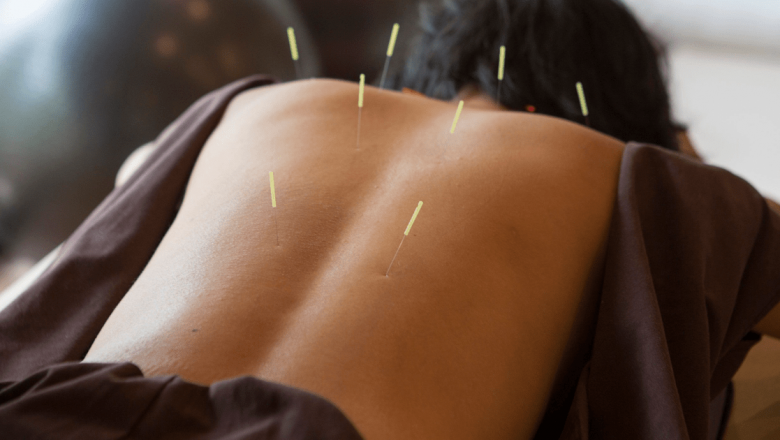 Acupunctura: O Cale Tradițională spre Vindecare în Medicina Alternativă