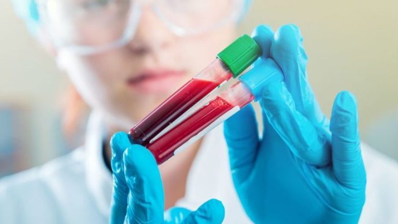 Limfoamele: O privire amplă asupra unui tip de cancer în expansiune