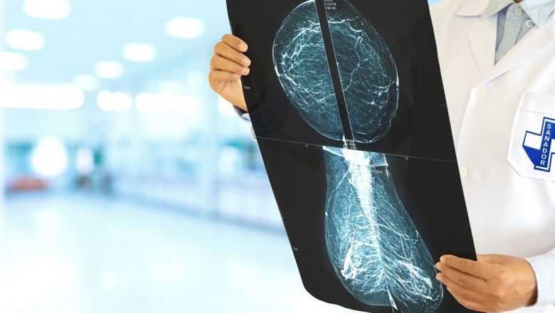 Ghid detaliat: Ce trebuie să faci dacă descoperi un nodul mamar