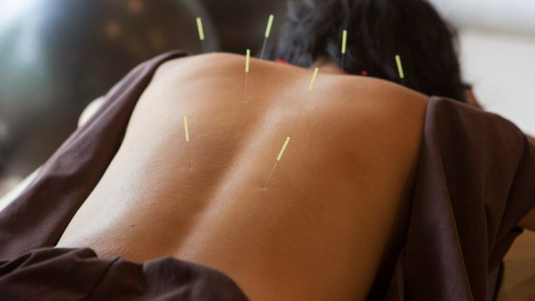 Acupunctura: O Privire Detaliată asupra Eficienței și Istoricii Metodei Tradiționale Chinezești de Vindecare