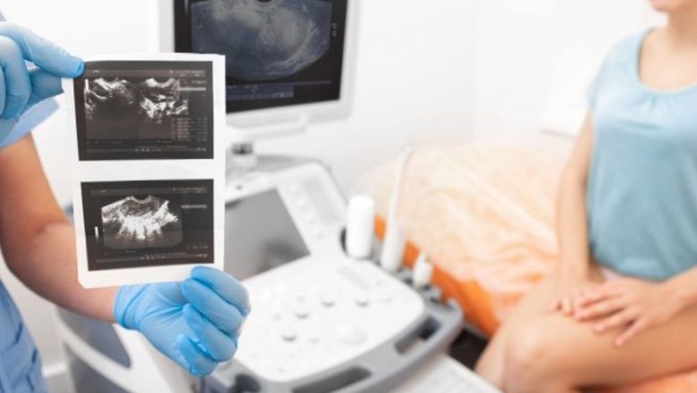 Ecografia Transvaginală: O Privire Detaliată Asupra Importanței și Utilizărilor Sale în Diagnosticul Ginecologic