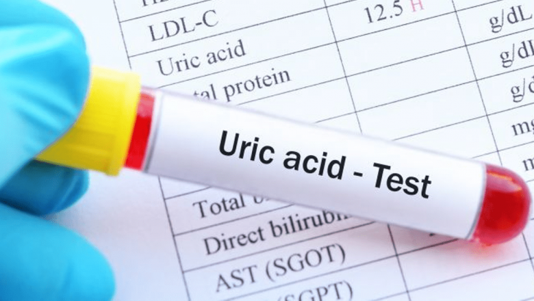 Hiperuricemia: Cauze, efecte și soluții pentru un acid uric crescut