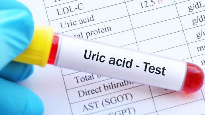 Hiperuricemia: Cauze, efecte și implicațiile acidului uric ridicat asupra sănătății