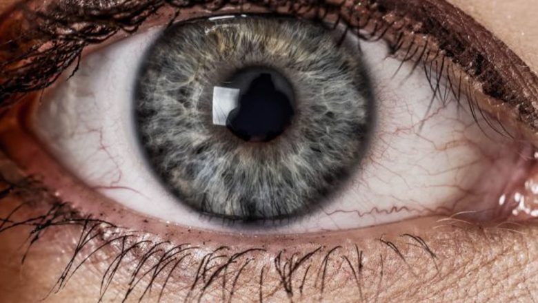Iridologia: O Fereastră Spre Sănătate prin Analiza Irisului