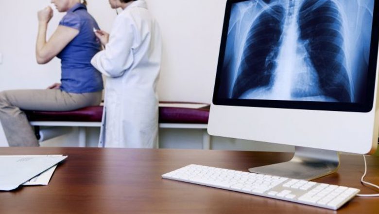 Cancerul pulmonar: O poveste de speranță și provocări în lupta pentru viață
